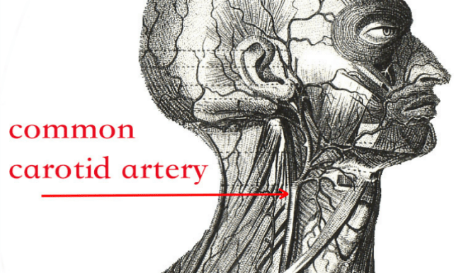 common carotid artery