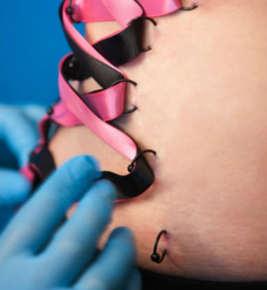 corset piercing
